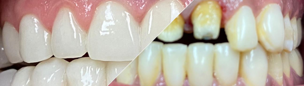 Yury Slepak, DDS - Bite Squad Dental of NYC's cover image