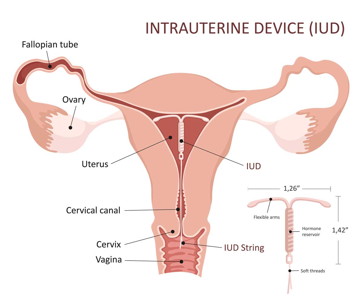 milcncookies's post 1