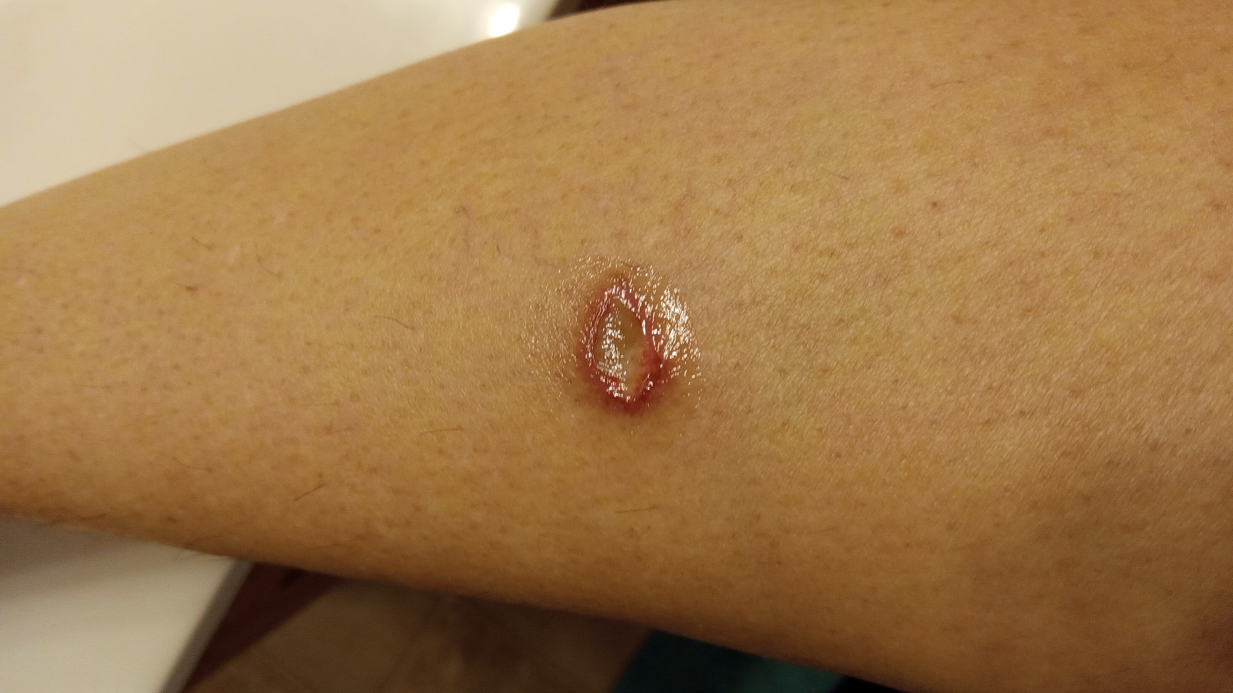 karen's post 2