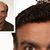 Wayne's Concept Hair Replacement's profile image