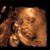 Diana Aleshire-Giron's profile image