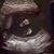 Lisa Kaye Brecht's profile image