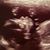 Joy Denise Partain's profile image