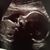 Brenda Turcotte Ruth's profile image