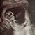 Katherine Meyer's profile image